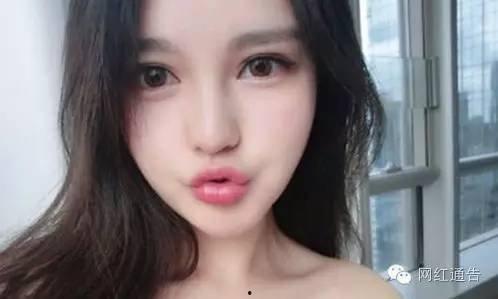 网红嘉欣整容爆料视频播放,网红整形风波视频播放量激增  第2张